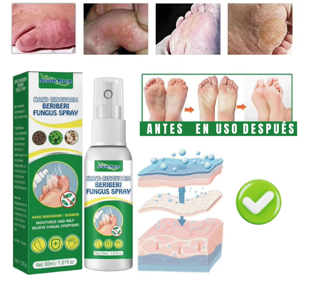 Spray Eliminador de Hongos