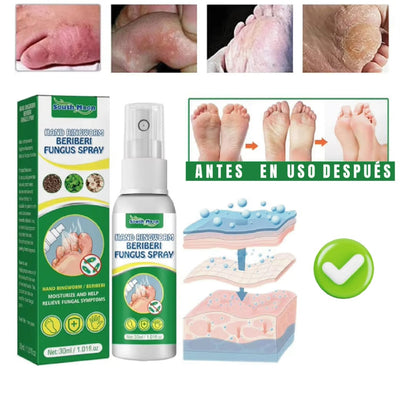 Spray Eliminador de Hongos