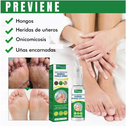 Spray Eliminador de Hongos